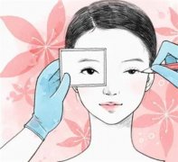 双眼皮太窄，能加宽吗